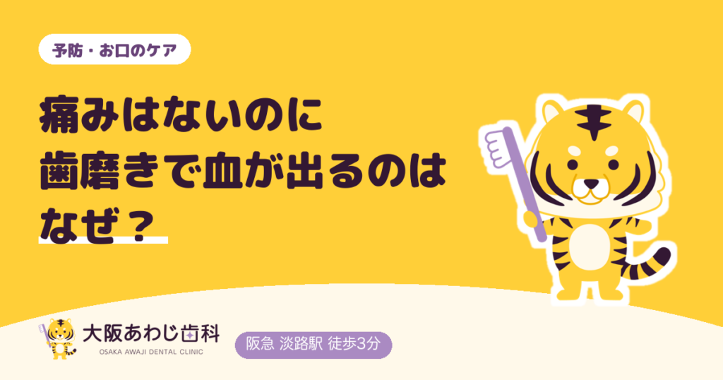 痛みはないのに歯磨きで血が出るのはなぜ？出たり出なかったりする理由と受診の目安